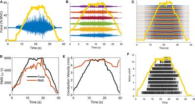 Surface Electromyography: What Limits Its Use in Exercise and Sport Physiology?